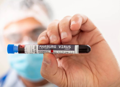 Virus Paling Berbahaya di Dunia